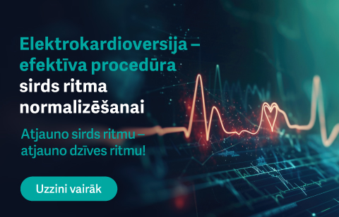 bez liekā svara ēnas!